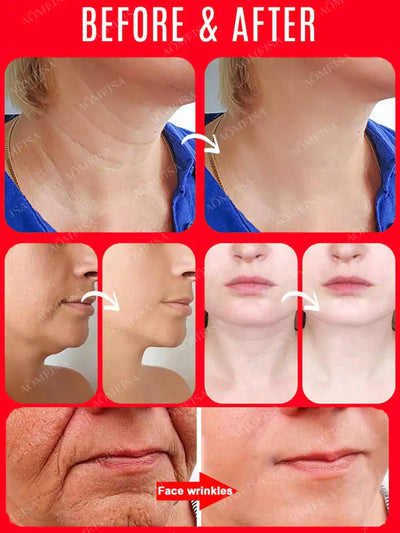 Eelhoe™ Anti-wrinkle anti-aging essence firming skin facial